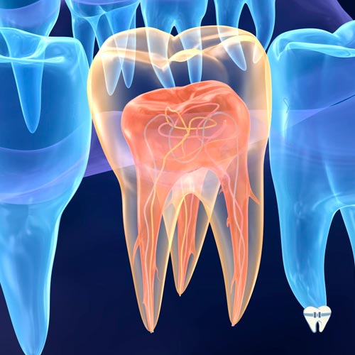 Endodontia - Tratamento de canal