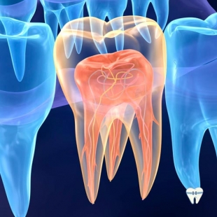 Endodontia / Tratamento de canal