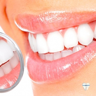 7 mitos e verdades sobre clareamento dental